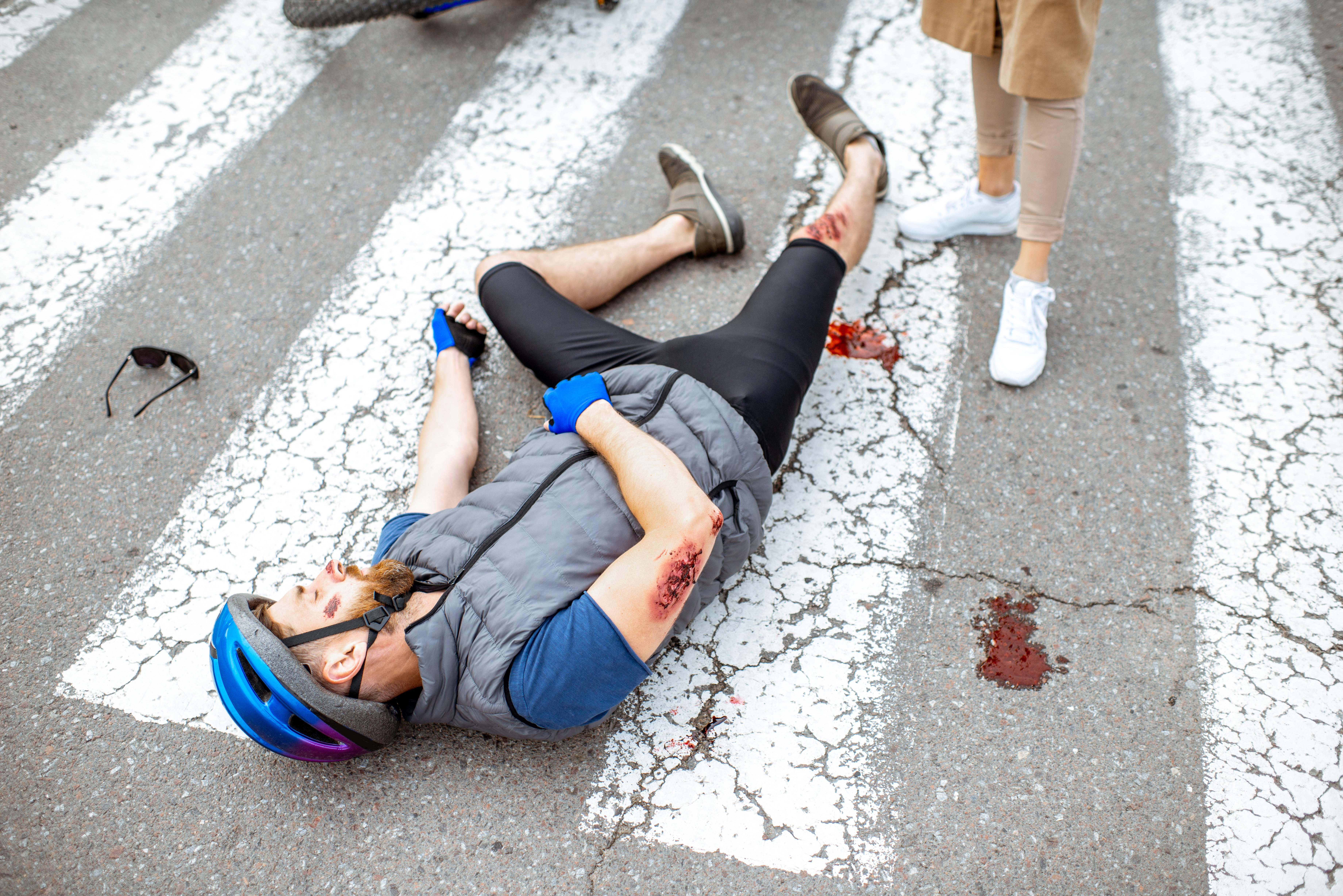 road-accident-with-injured-cyclist-and-car-2023-11-27-05-13-31-utc